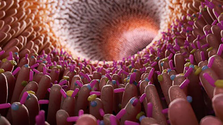 Svizzera: aumento dei tumori a esordio precoce, sfide per la sanità