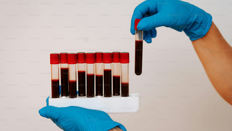 Il gruppo sanguigno più raro al mondo: Gwada Negativo