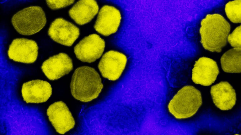 Febbre Gialla: tutto quello che c’è da sapere sulla “malattia delle zone tropicali”