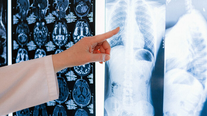 Risonanza magnetica, il salto tecnologico che può cambiare diagnosi e tempi di cura